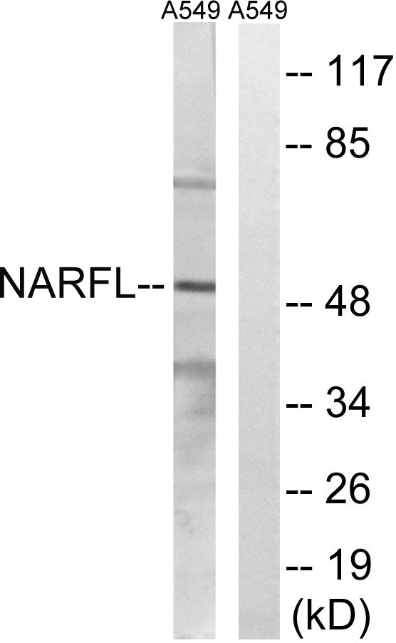 NARFL Rabbit Polyclonal Antibody