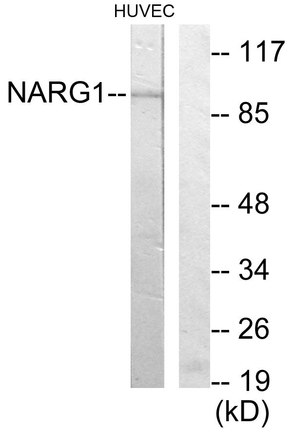NARG1 Rabbit Polyclonal Antibody