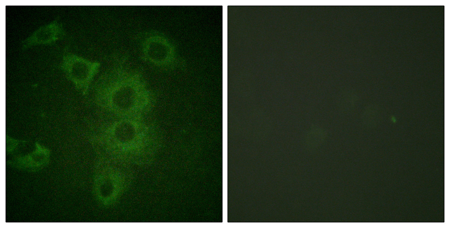 NBK Rabbit Polyclonal Antibody
