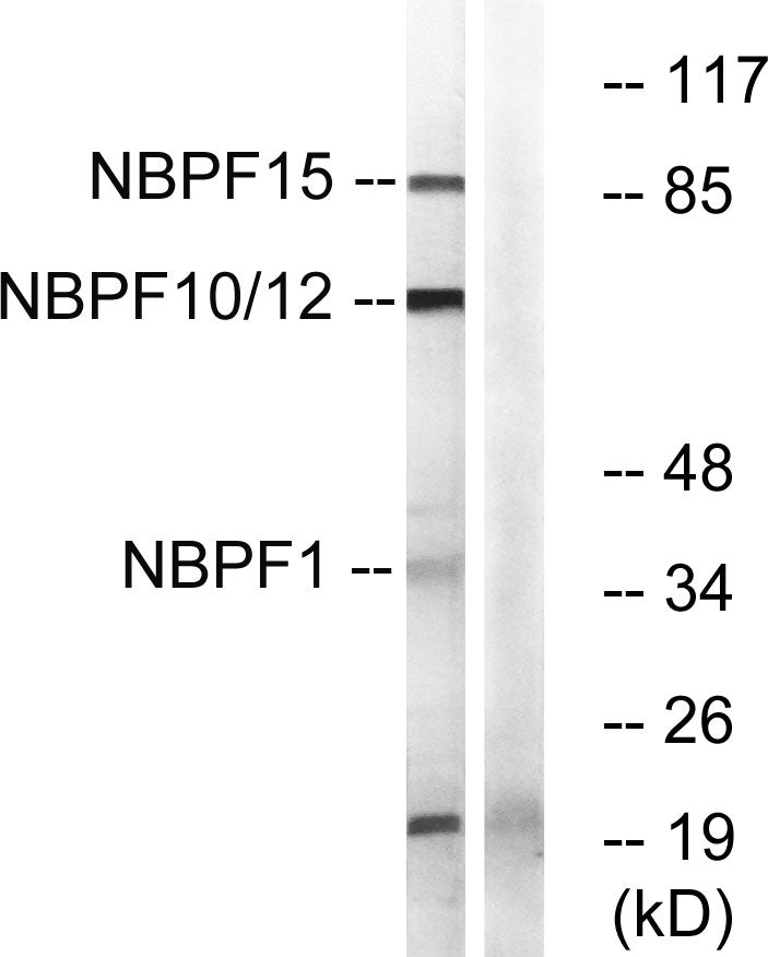 NBPF1/9/10/12/14/15/16/20 Rabbit Polyclonal Antibody