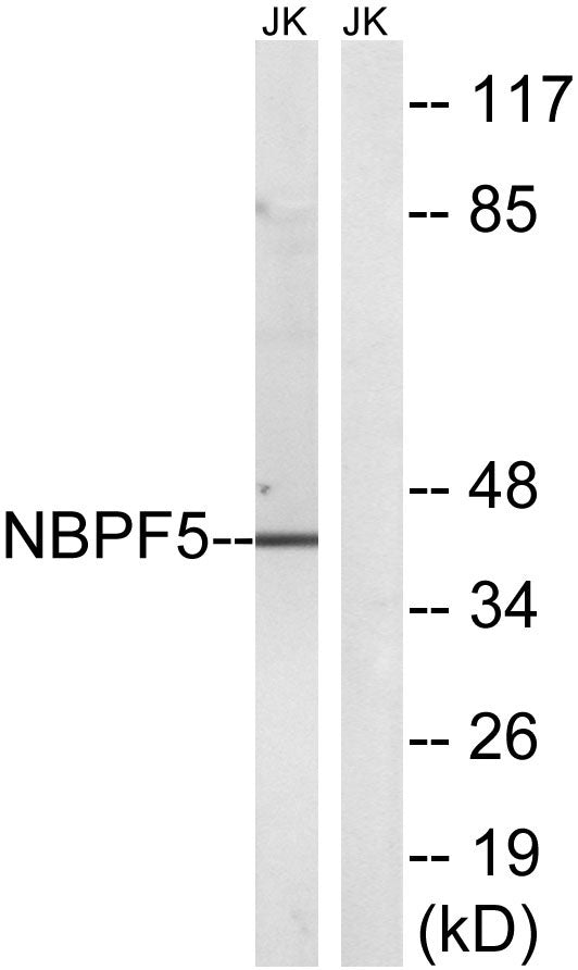 NBPF5 Rabbit Polyclonal Antibody