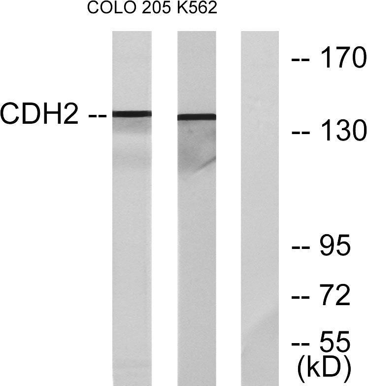 N-cadherin Rabbit Polyclonal Antibody