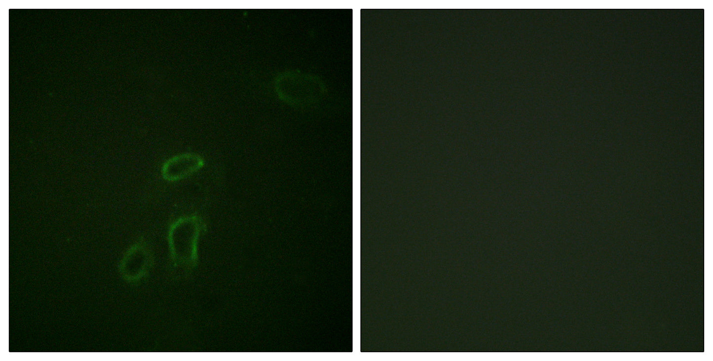NCAM-L1 Rabbit Polyclonal Antibody