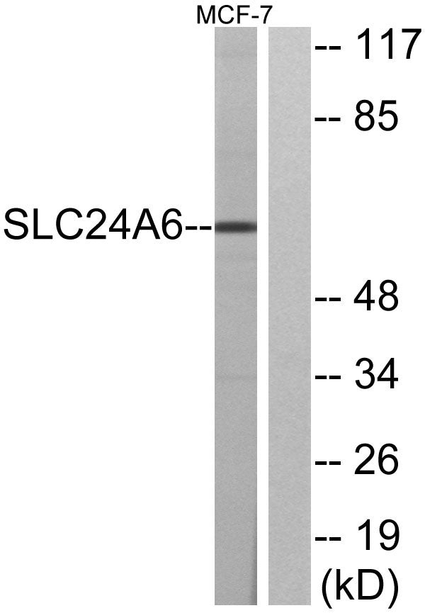 NCKX6 Rabbit Polyclonal Antibody