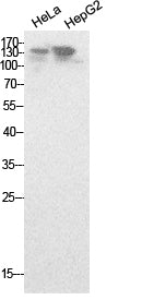NCoA-3 Rabbit Polyclonal Antibody