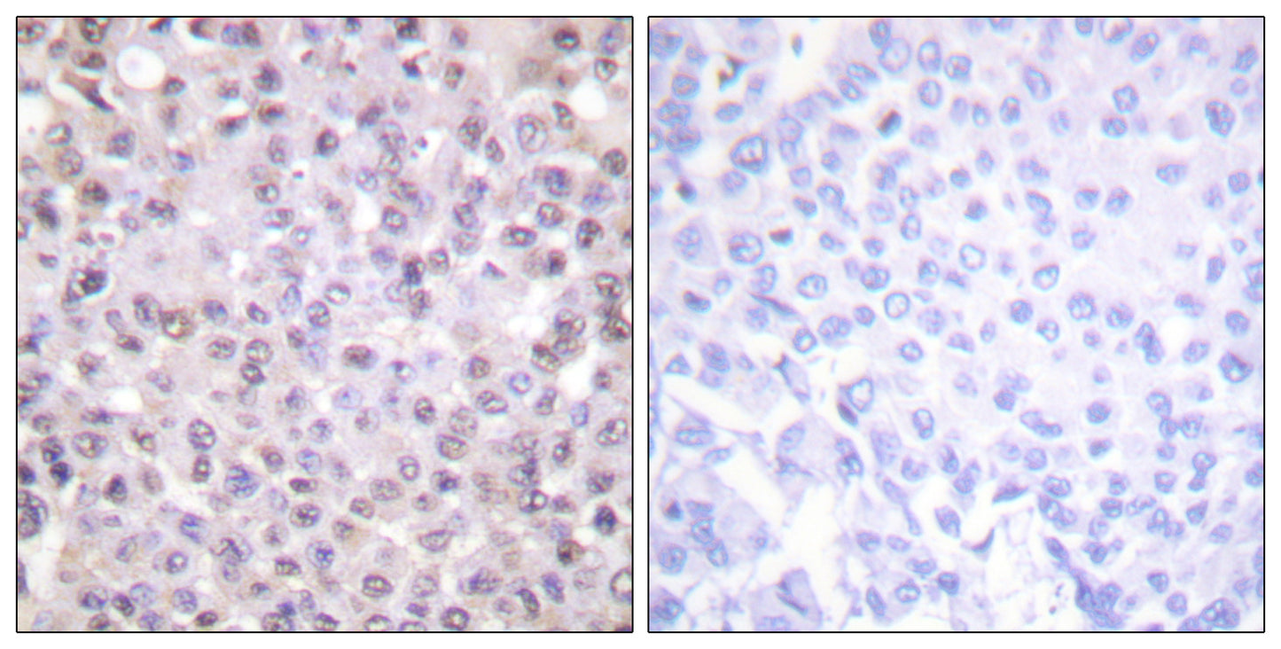 N-CoR Rabbit Polyclonal Antibody