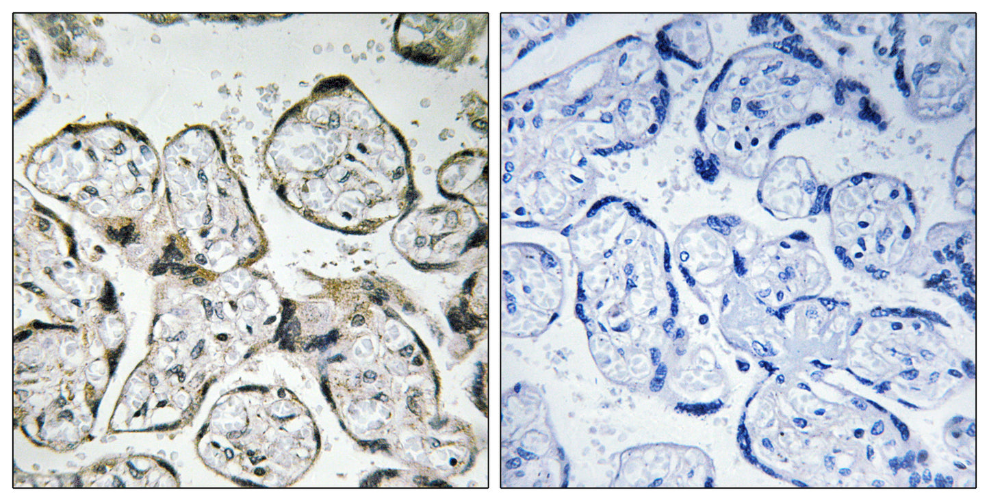 ND1 Rabbit Polyclonal Antibody