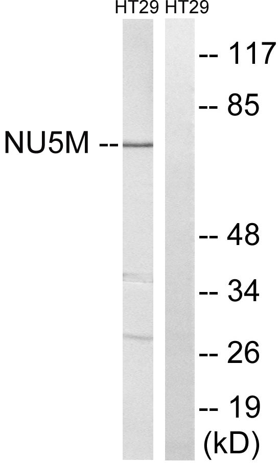 ND5 Rabbit Polyclonal Antibody