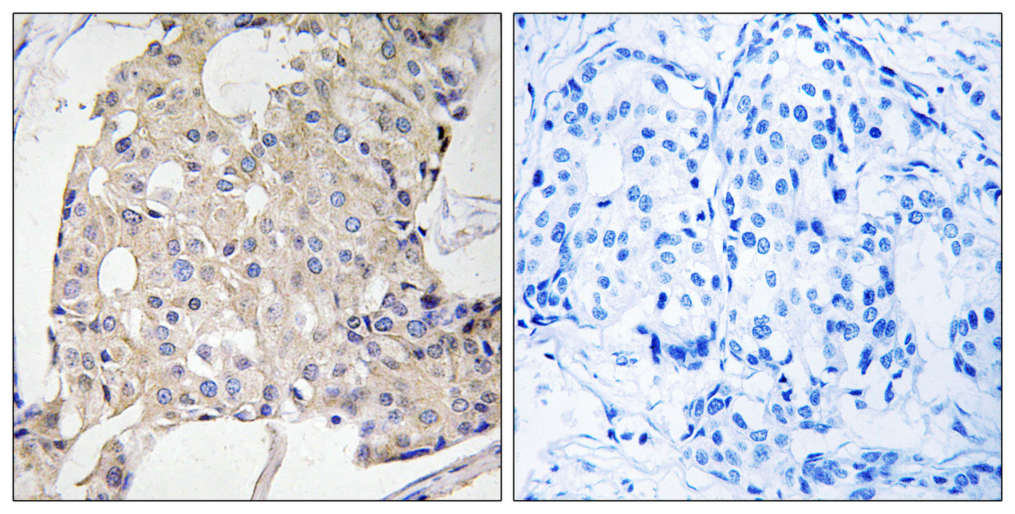 NDRG3 Rabbit Polyclonal Antibody