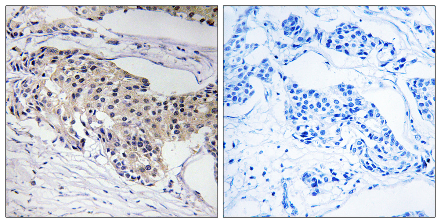 NDUFA3 Rabbit Polyclonal Antibody