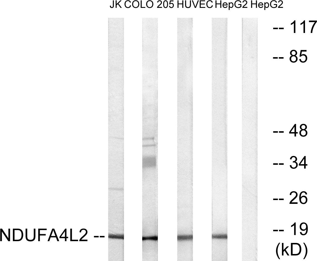 NDUFA4L2 Rabbit Polyclonal Antibody