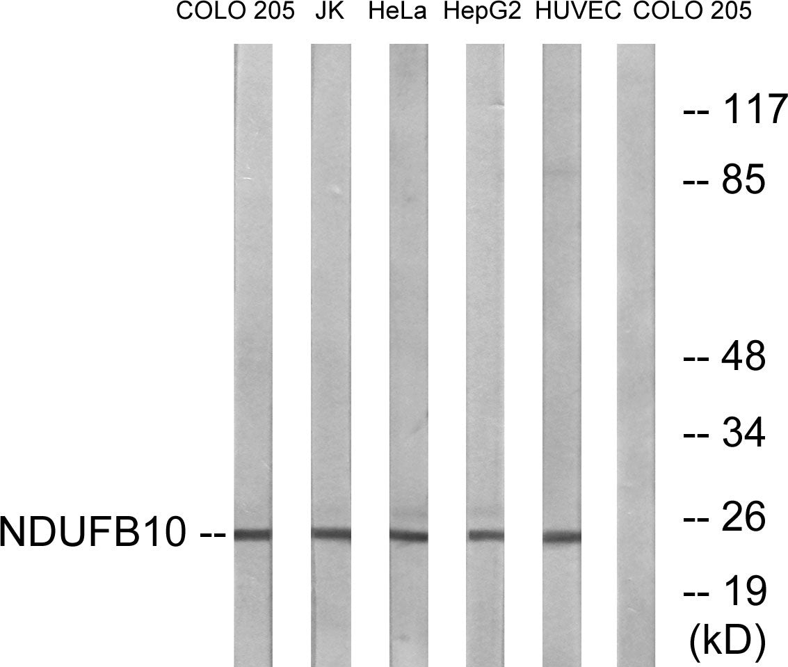 NDUFB10 Rabbit Polyclonal Antibody