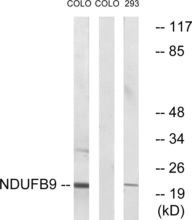 NDUFB9 Rabbit Polyclonal Antibody
