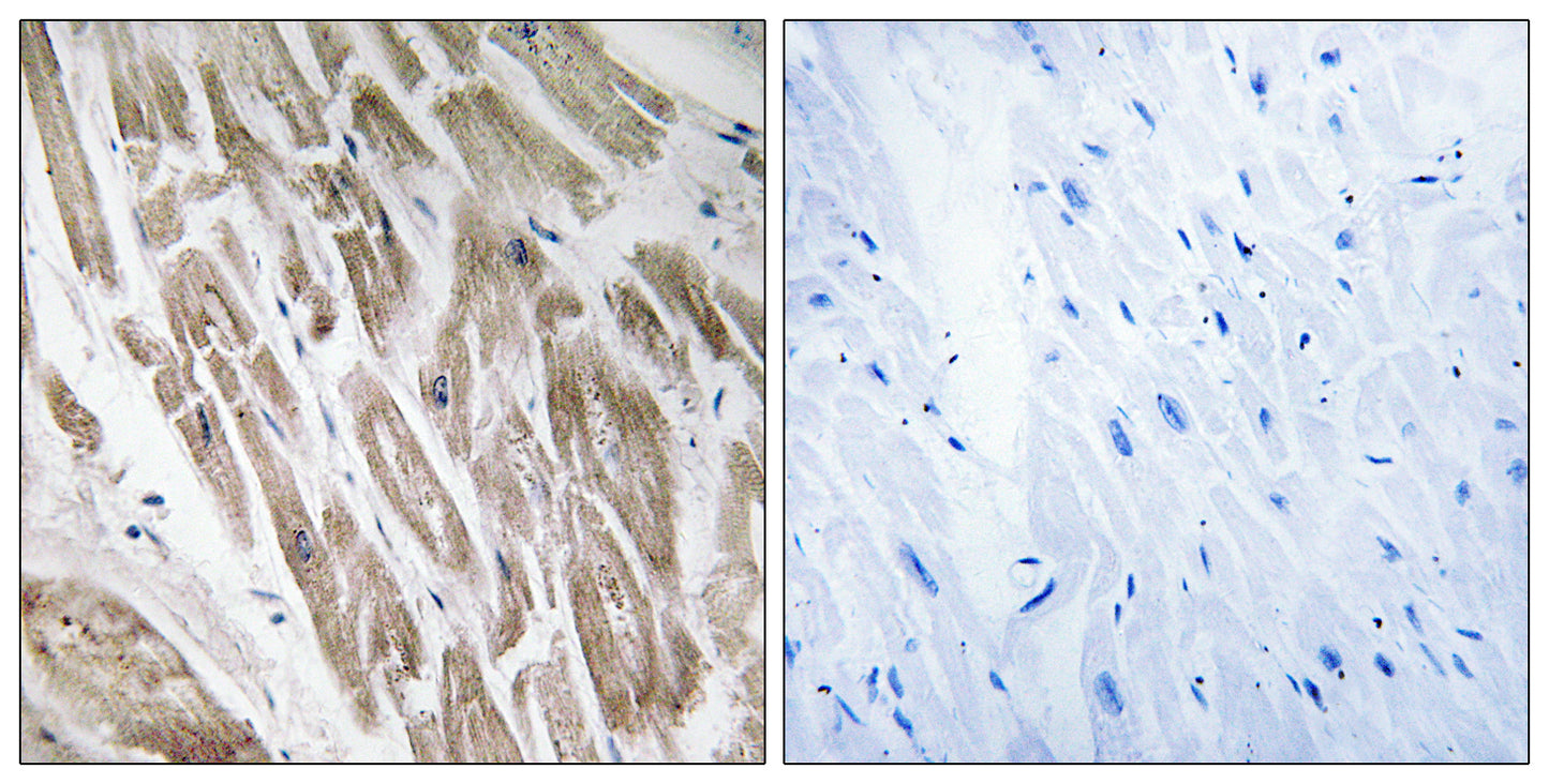 NDUFS5 Rabbit Polyclonal Antibody