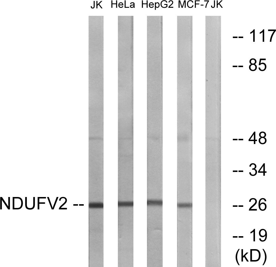 NDUFV2 Rabbit Polyclonal Antibody
