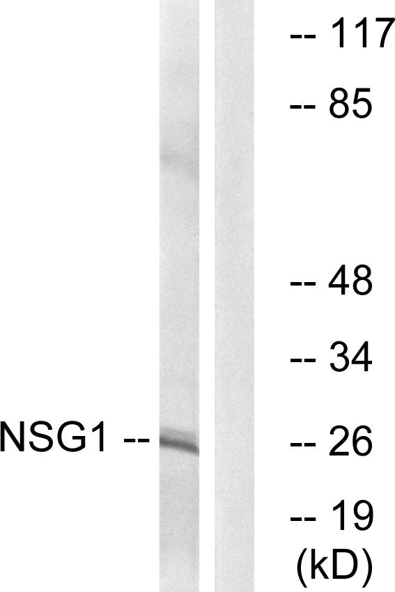 NEEP21 Rabbit Polyclonal Antibody
