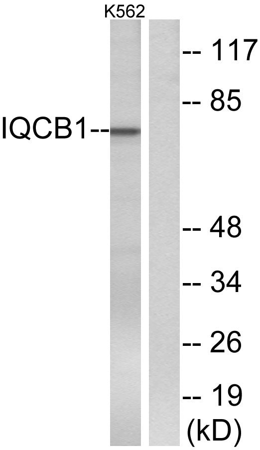 Nephrocystin-5 Rabbit Polyclonal Antibody