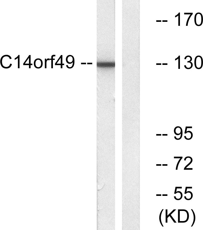 Nesprin-3 Rabbit Polyclonal Antibody