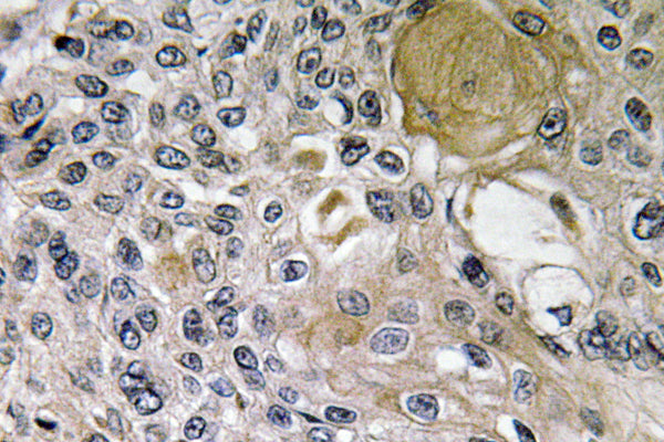 Netrin-1 Rabbit Polyclonal Antibody