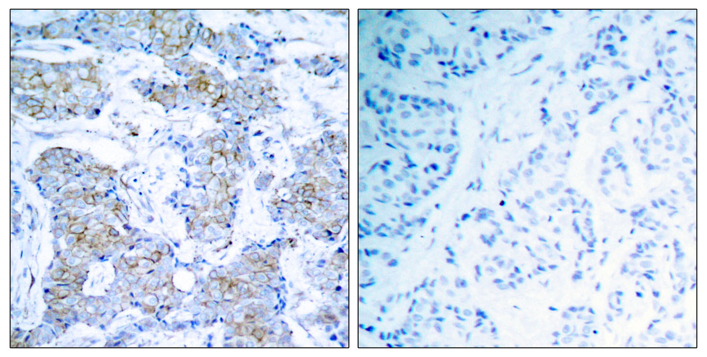 Neu Rabbit Polyclonal Antibody