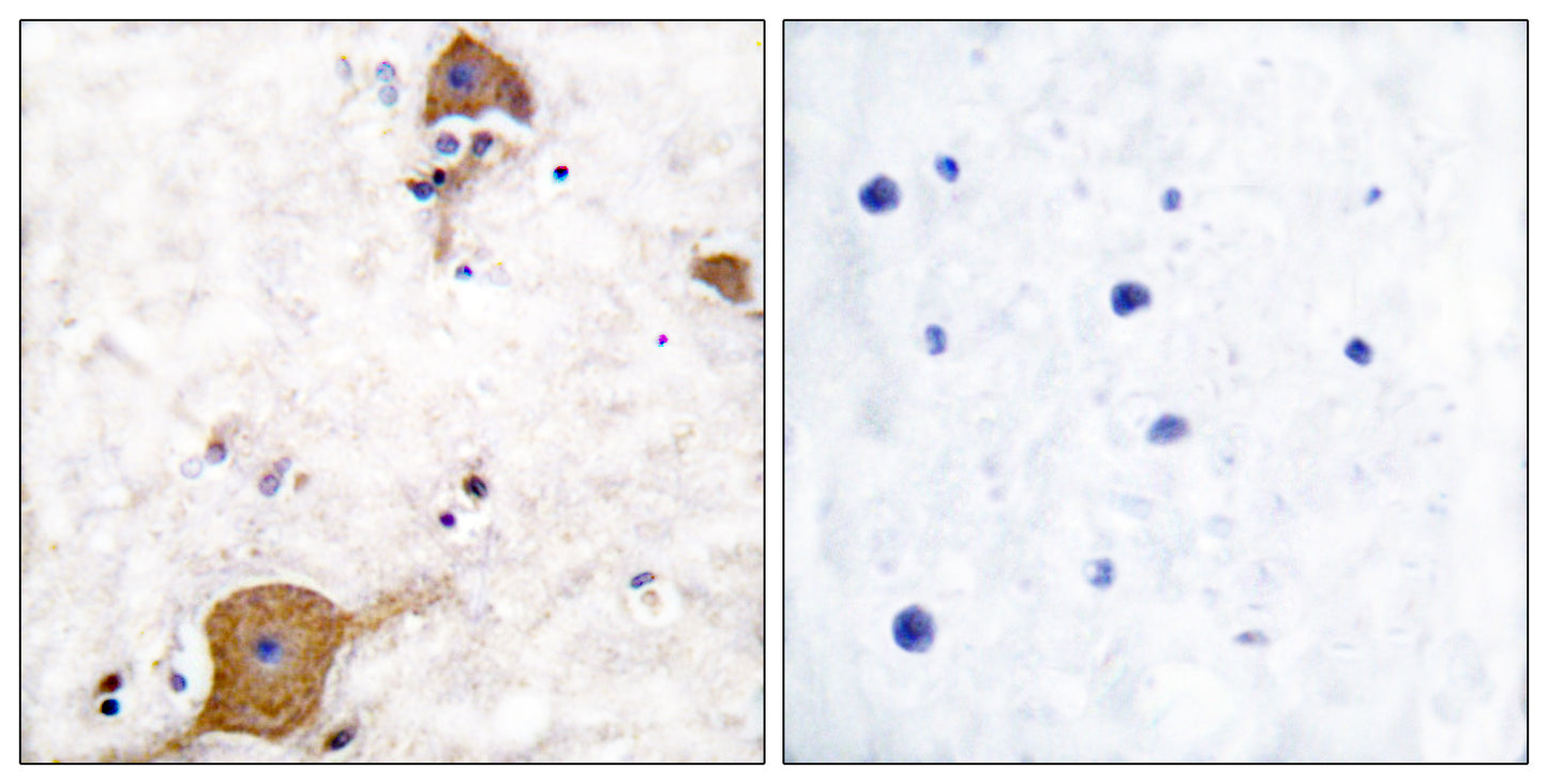 Neuregulin-1 SMDF Rabbit Polyclonal Antibody
