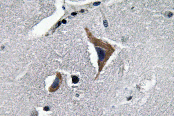 Neurophysin I Rabbit Polyclonal Antibody