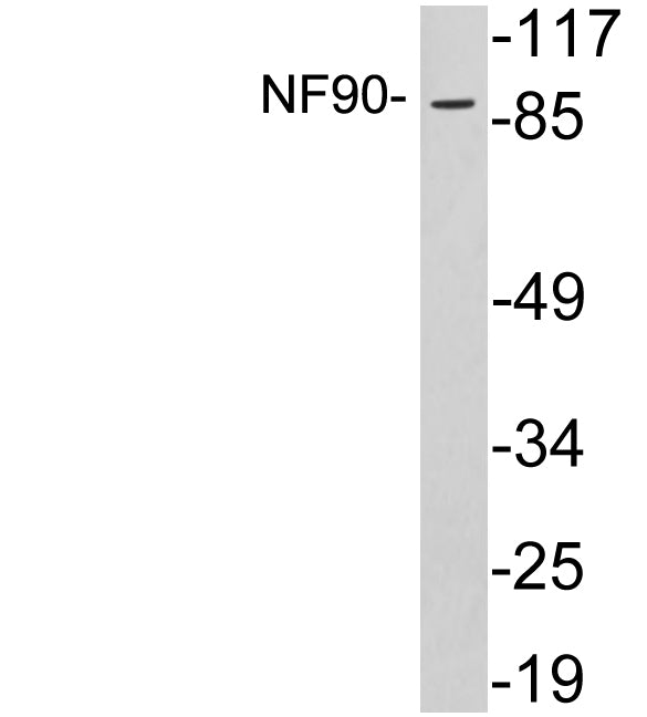 NF90 Rabbit Polyclonal Antibody