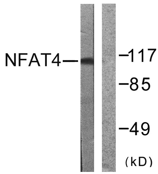 NFATc3 Rabbit Polyclonal Antibody