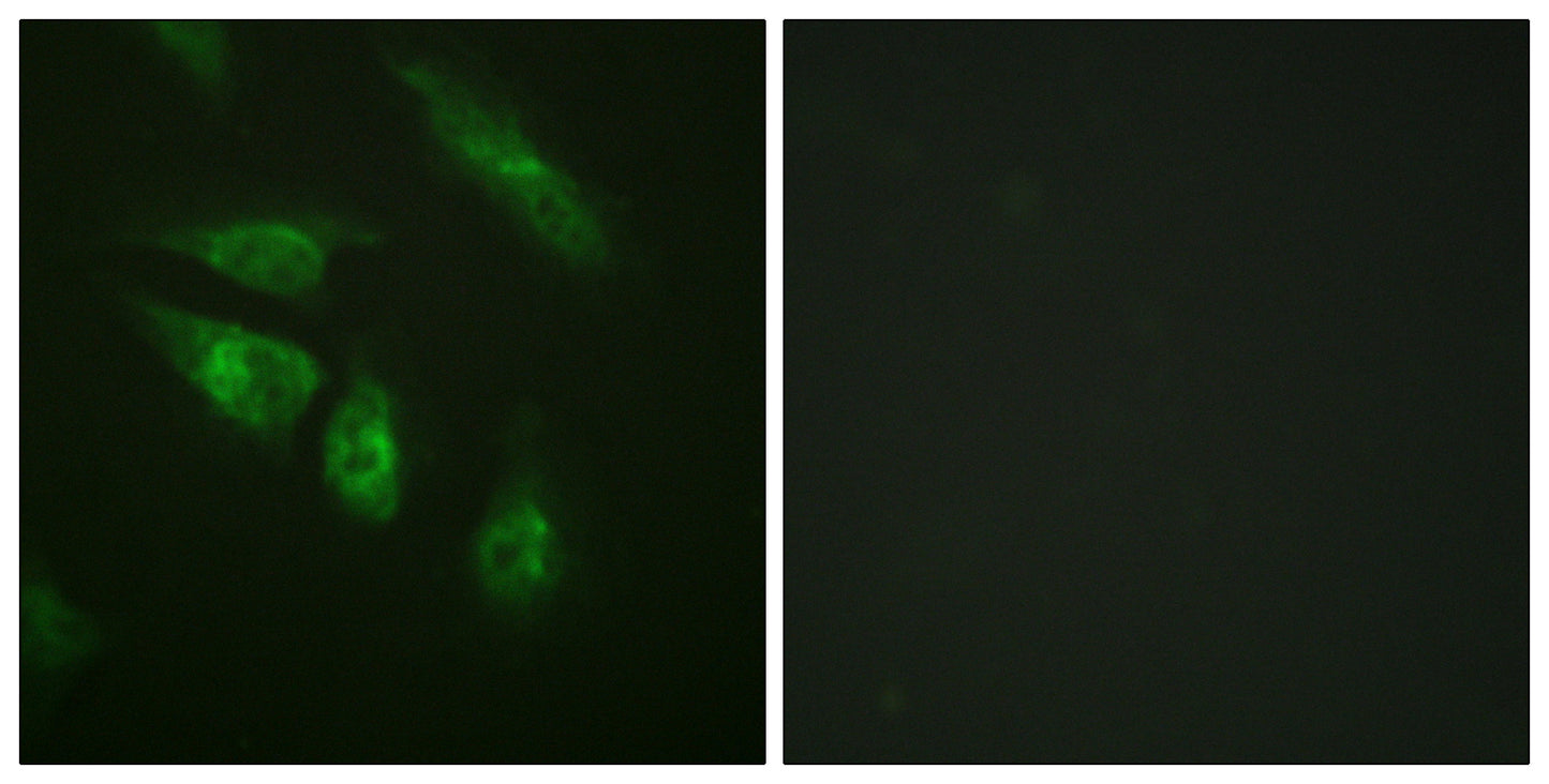 NFATc4 Rabbit Polyclonal Antibody