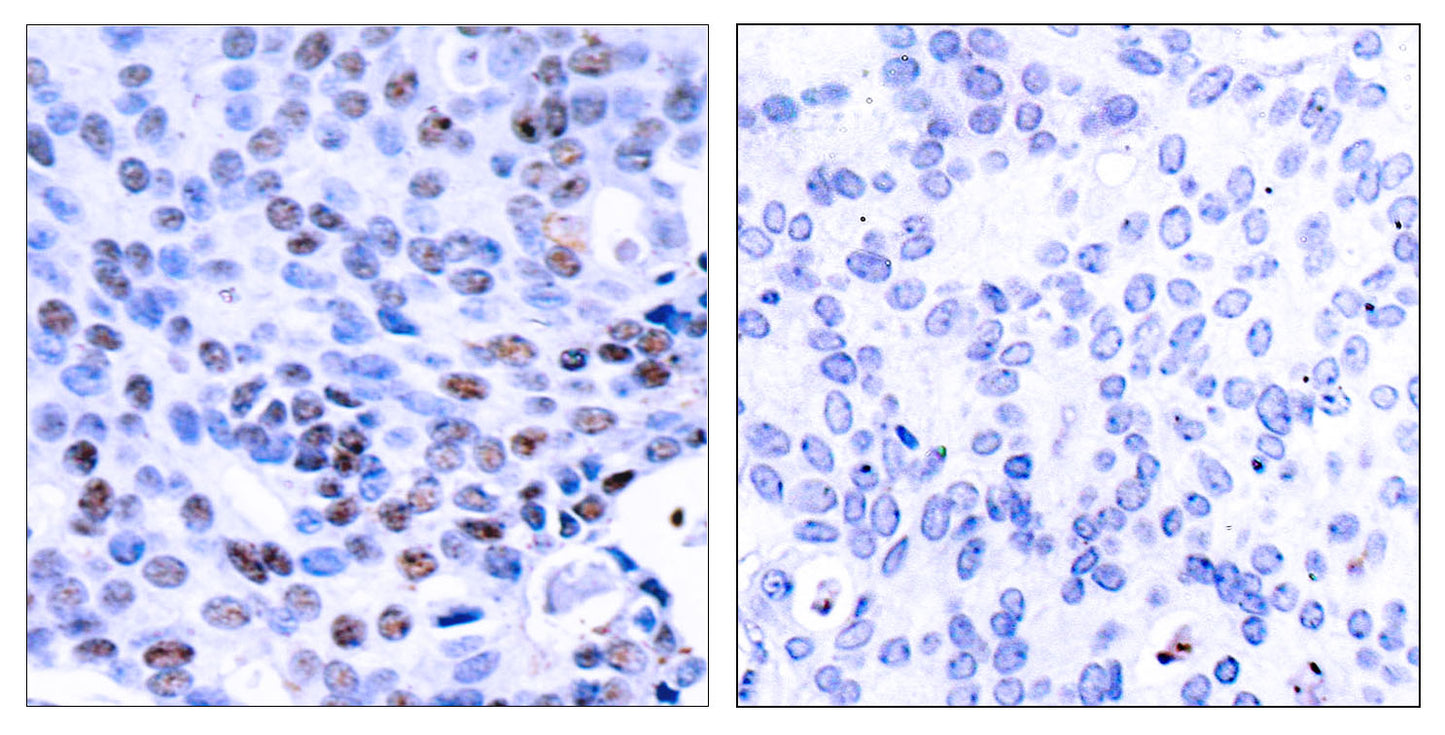 NFκB-p105/p50 Rabbit Polyclonal Antibody
