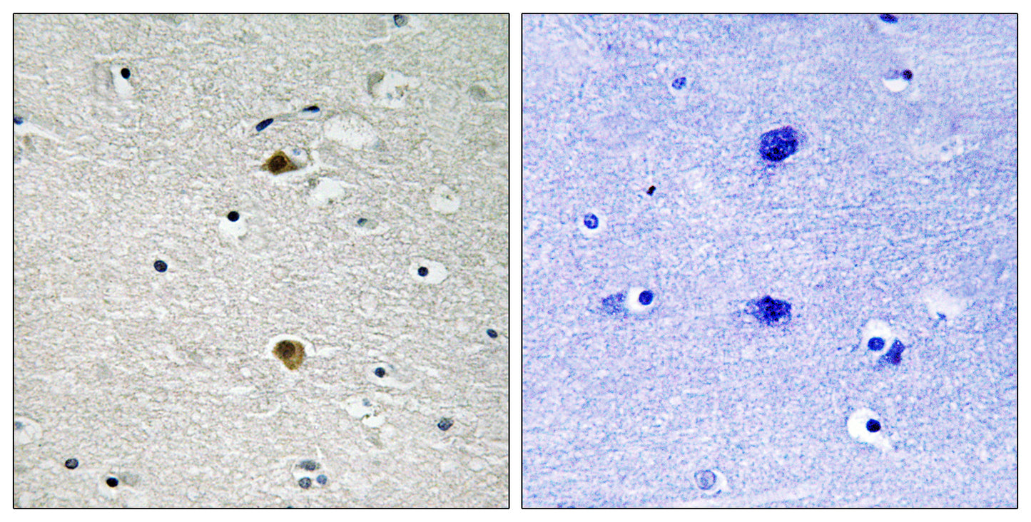 NFκB-p65 Rabbit Polyclonal Antibody