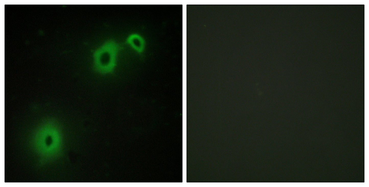 NGFR p75 Rabbit Polyclonal Antibody