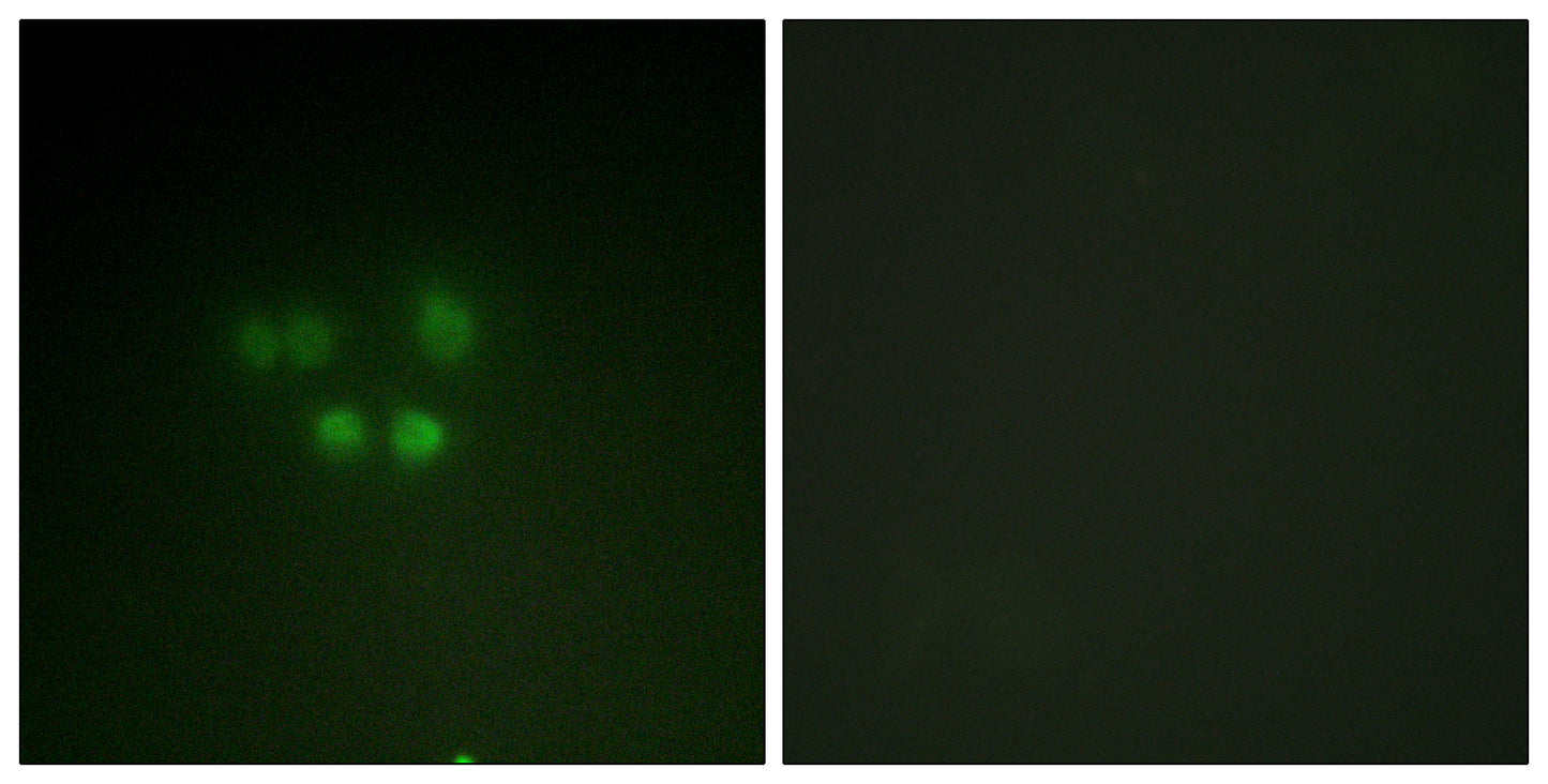 Nibrin Rabbit Polyclonal Antibody