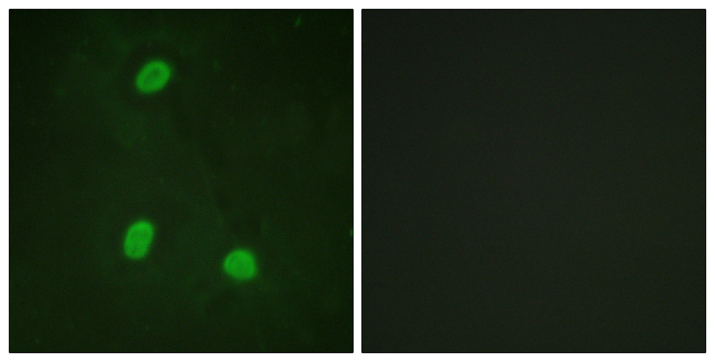NIPA Rabbit Polyclonal Antibody