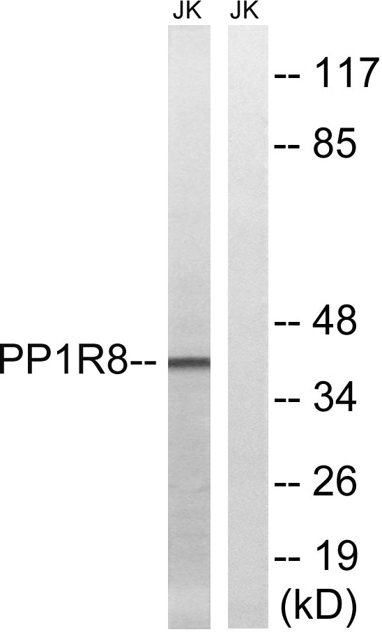 NIPP1 Rabbit Polyclonal Antibody