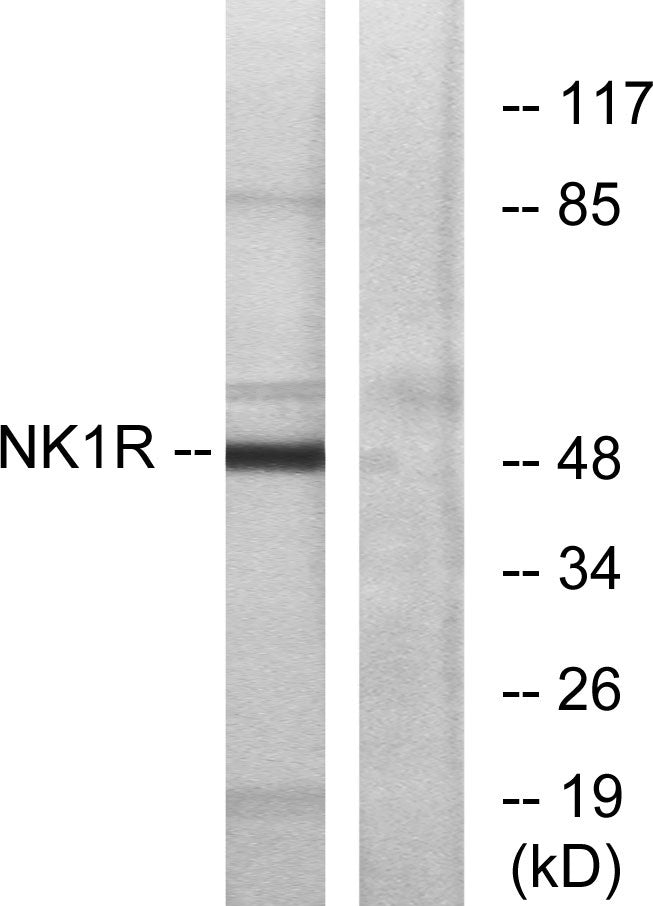 NK-1R Rabbit Polyclonal Antibody