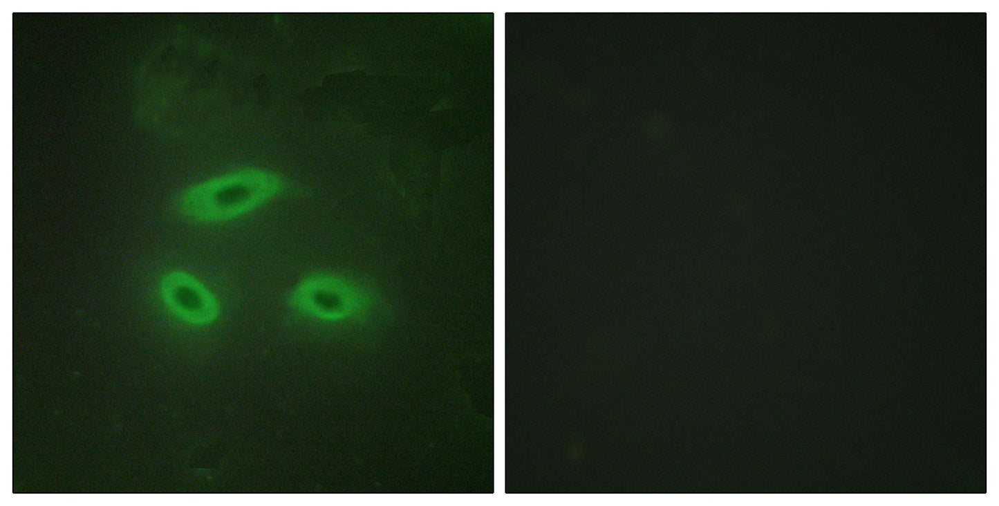 NK-TR Rabbit Polyclonal Antibody