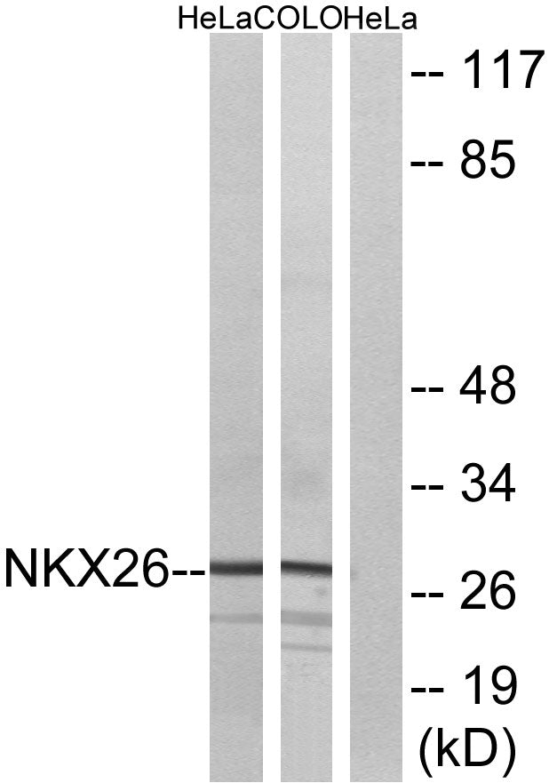 Nkx-2.6 Rabbit Polyclonal Antibody