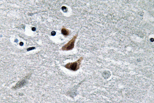 NM23-H1 Rabbit Polyclonal Antibody