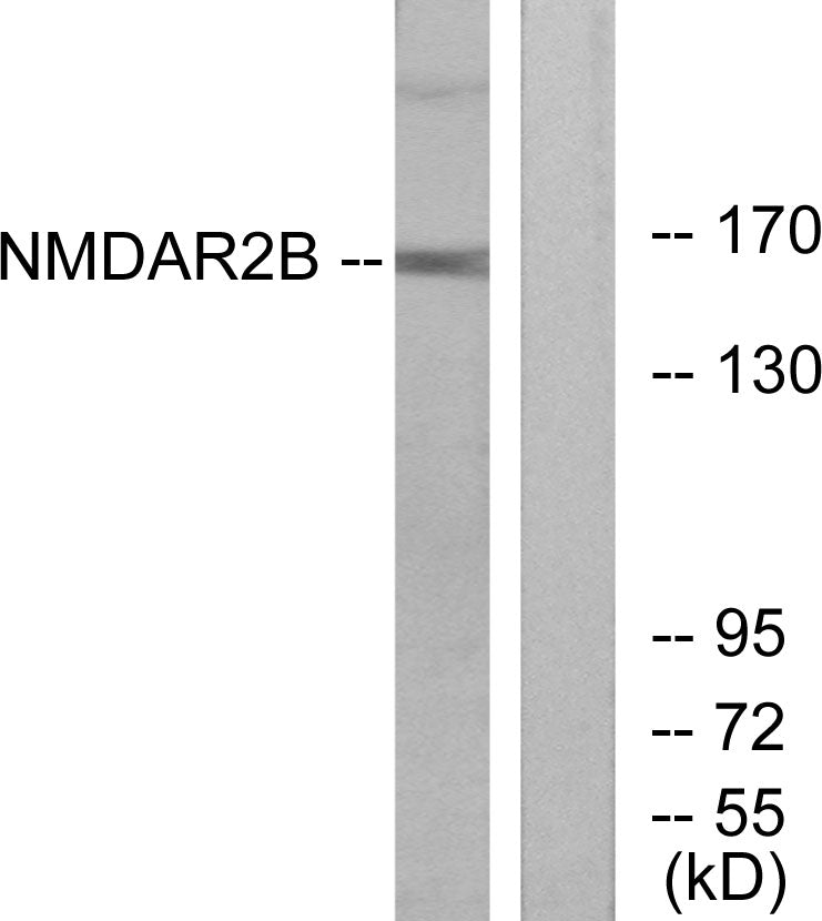 NMDAε2 Rabbit Polyclonal Antibody