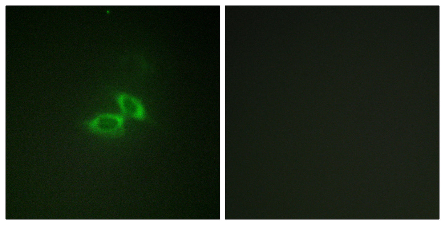 NMDAζ1 Rabbit Polyclonal Antibody