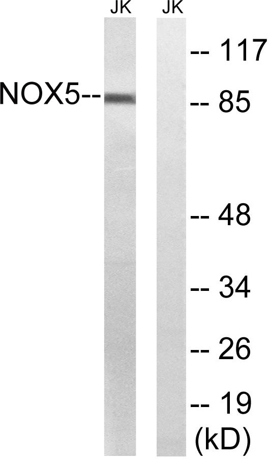 Nox5 Rabbit Polyclonal Antibody