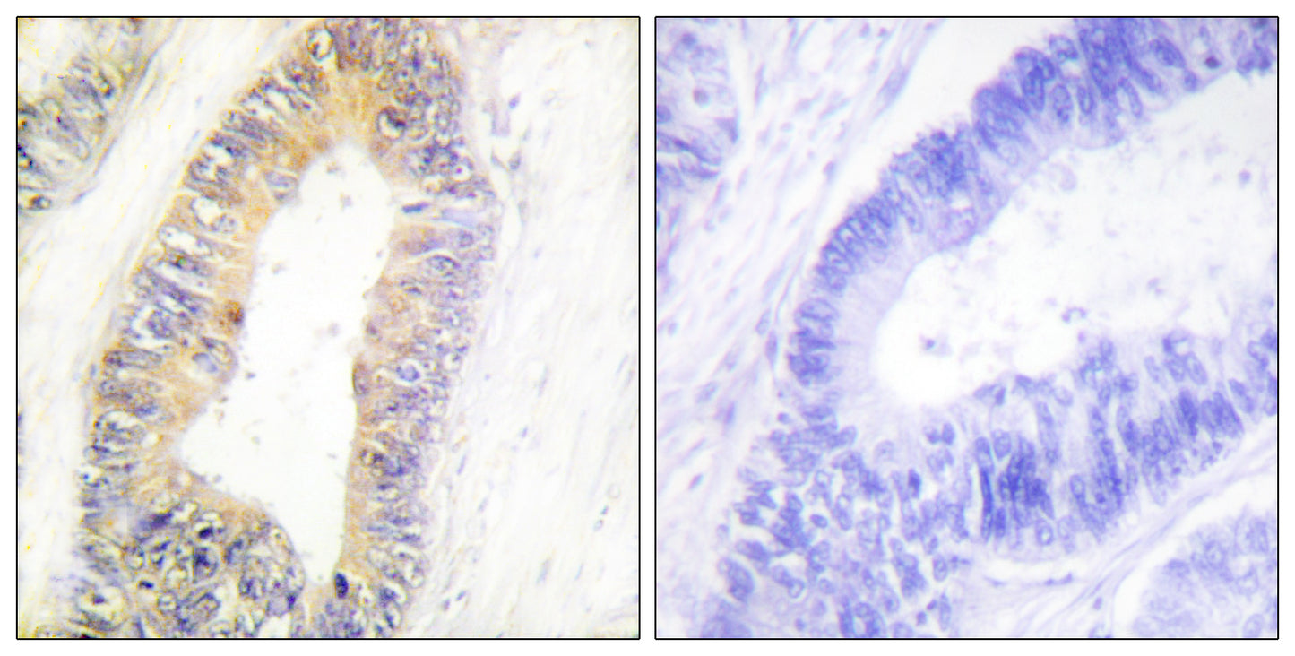 NP220 Rabbit Polyclonal Antibody