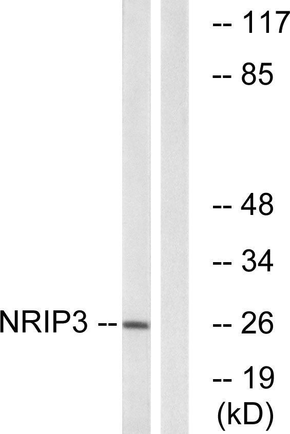 NRIP3 Rabbit Polyclonal Antibody