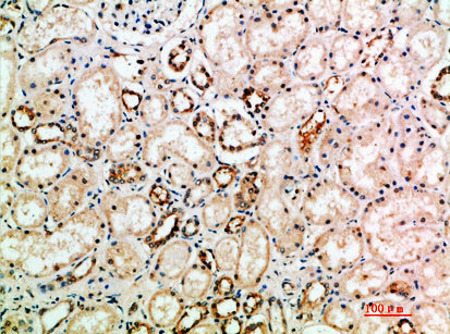 NT-3 Rabbit Polyclonal Antibody