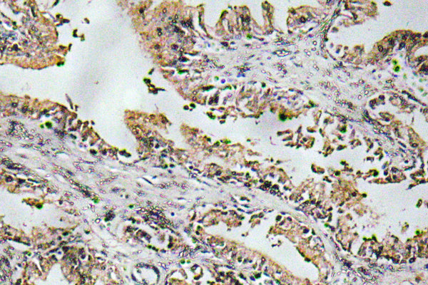 NT-4 Rabbit Polyclonal Antibody