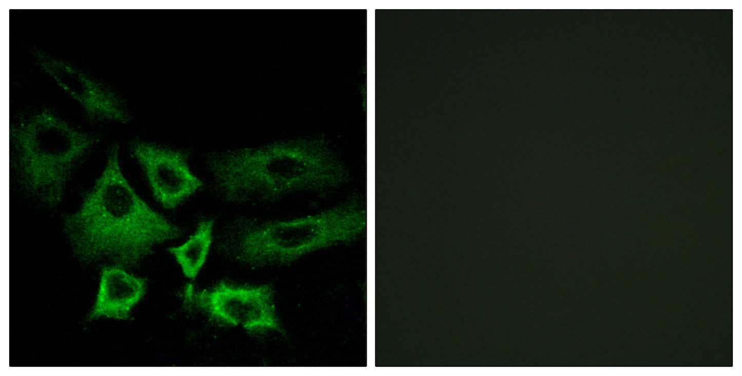 NT5C1A Rabbit Polyclonal Antibody