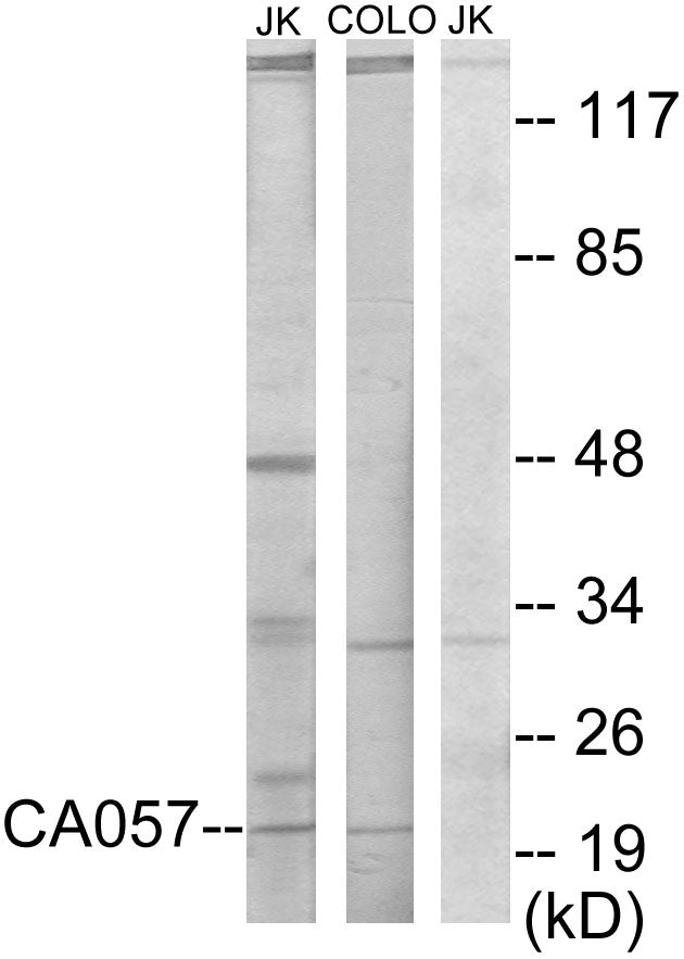 NTPase Rabbit Polyclonal Antibody