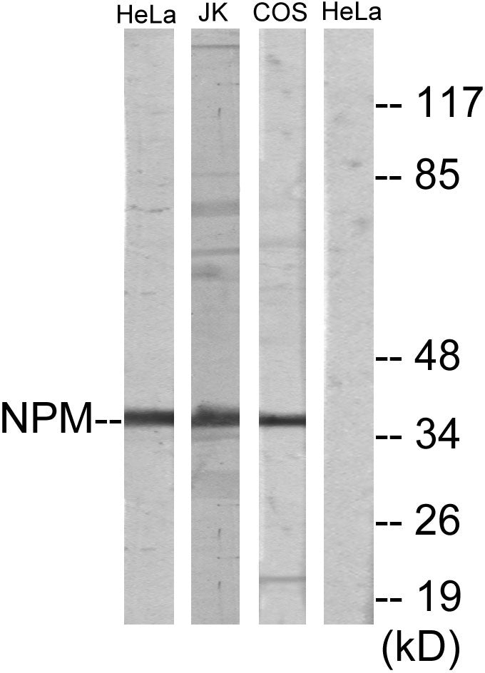 Nucleophosmin Rabbit Polyclonal Antibody
