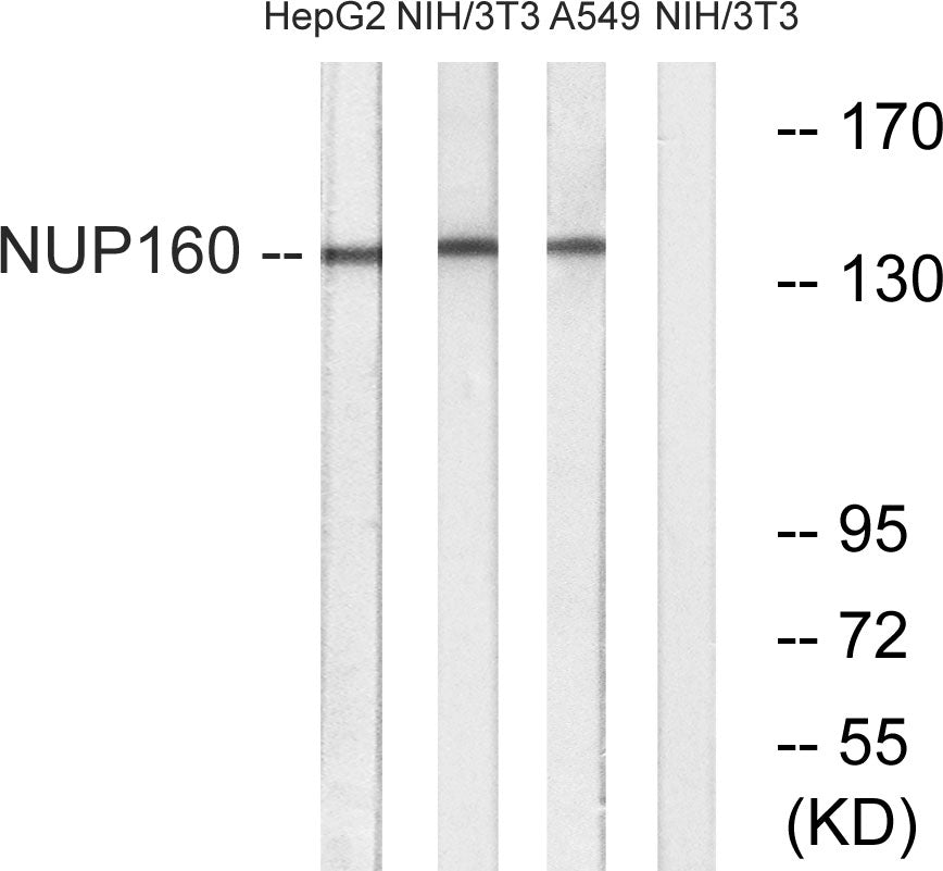 Nup160 Rabbit Polyclonal Antibody
